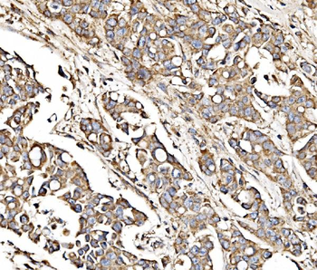 MPPB/PMPCB Rabbit Polyclonal Antibody