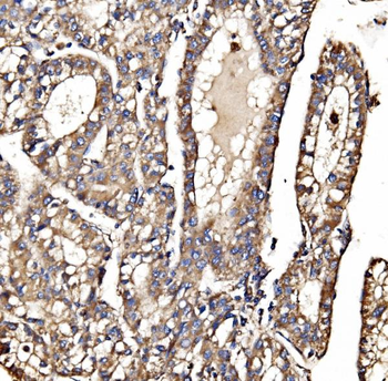MPPB/PMPCB Rabbit Polyclonal Antibody