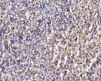 MPPB/PMPCB Rabbit Polyclonal Antibody