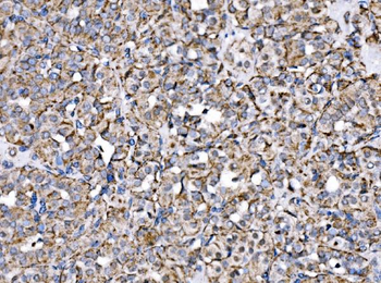 MPPB/PMPCB Rabbit Polyclonal Antibody