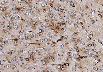 MPPB/PMPCB Rabbit Polyclonal Antibody
