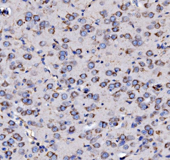 MPPB/PMPCB Rabbit Polyclonal Antibody