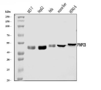 MPPB/PMPCB Rabbit Polyclonal Antibody