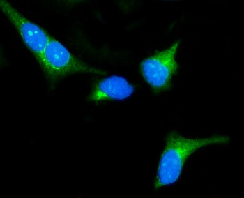 PKA R2/PKR2/PRKAR2A Rabbit Polyclonal Antibody