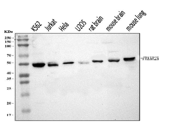 PKA R2/PKR2/PRKAR2A Rabbit Polyclonal Antibody