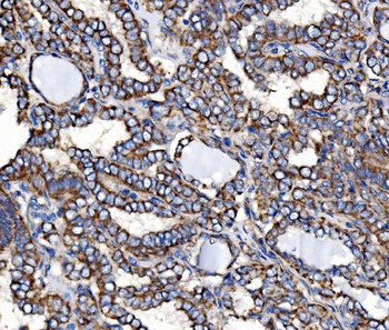 Paxillin/PXN Rabbit Polyclonal Antibody