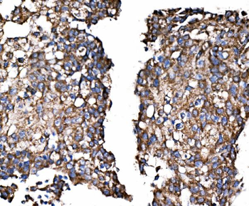 Paxillin/PXN Rabbit Polyclonal Antibody