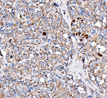 Paxillin/PXN Rabbit Polyclonal Antibody