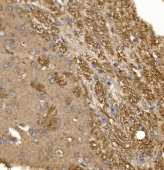 Paxillin/PXN Rabbit Polyclonal Antibody