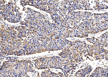 QSOX2 Rabbit Polyclonal Antibody