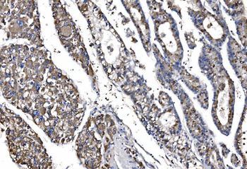 QSOX2 Rabbit Polyclonal Antibody