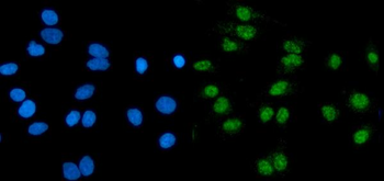 RNF20 Rabbit Polyclonal Antibody