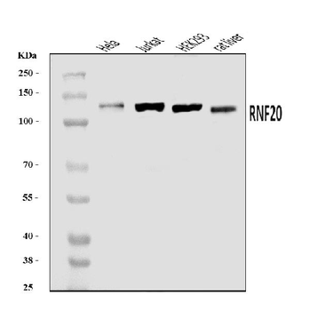 RNF20 Rabbit Polyclonal Antibody