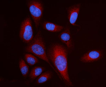 RPL17 Antibody
