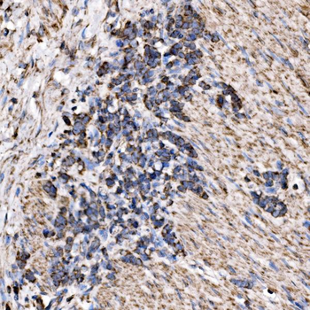 RPL17 Antibody