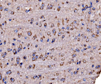 RPL17 Antibody