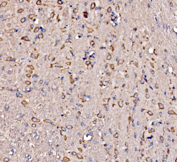 RPL17 Antibody