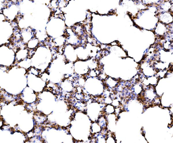 RPL17 Antibody