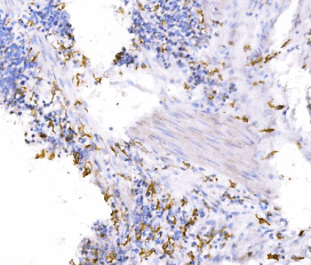 SH3GL2 Rabbit Polyclonal Antibody