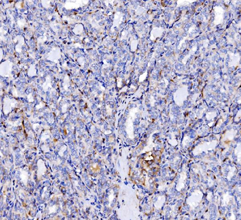 SH3GL2 Rabbit Polyclonal Antibody