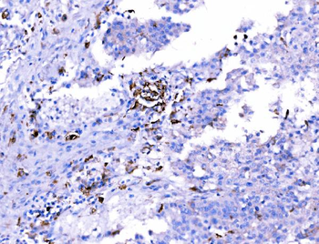 SH3GL2 Rabbit Polyclonal Antibody