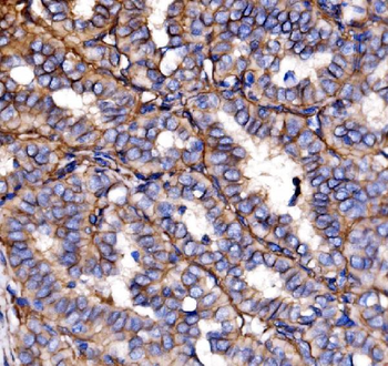 NEAS/SPTAN1 Rabbit Polyclonal Antibody