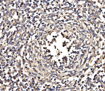 NEAS/SPTAN1 Rabbit Polyclonal Antibody