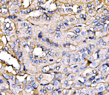 NEAS/SPTAN1 Rabbit Polyclonal Antibody