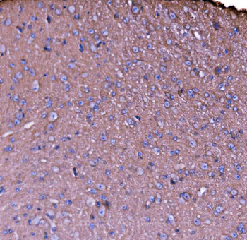 NEAS/SPTAN1 Rabbit Polyclonal Antibody