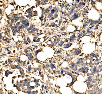SRP72 Rabbit Polyclonal Antibody