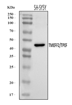 TMEFF2 Rabbit Polyclonal Antibody