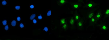 USP5 Rabbit Polyclonal Antibody