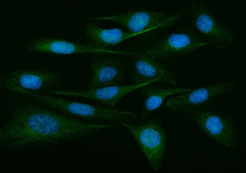 ADAM9 Rabbit Polyclonal Antibody