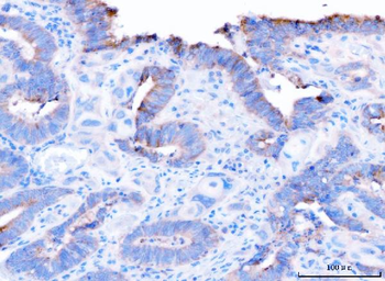 ADAM9 Rabbit Polyclonal Antibody