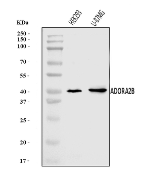 ADORA2B Rabbit Polyclonal Antibody