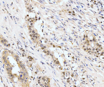 AKAP 95/AKAP8 Rabbit Polyclonal Antibody