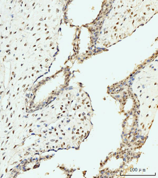 AKAP 95/AKAP8 Rabbit Polyclonal Antibody
