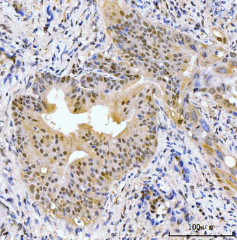 AKAP 95/AKAP8 Rabbit Polyclonal Antibody