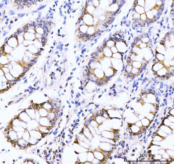 AKAP 95/AKAP8 Rabbit Polyclonal Antibody