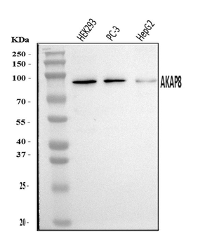 AKAP 95/AKAP8 Rabbit Polyclonal Antibody