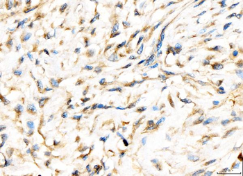 AP2A2 Rabbit Polyclonal Antibody
