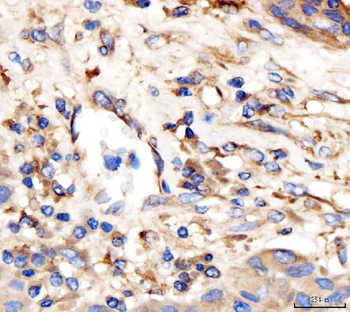 AP2A2 Rabbit Polyclonal Antibody
