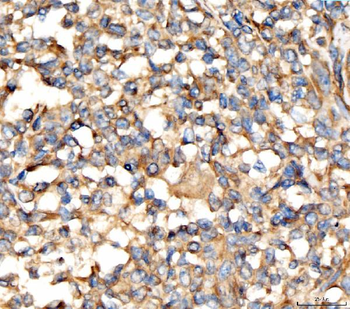 AP2A2 Rabbit Polyclonal Antibody