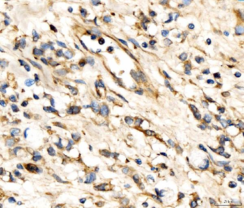 AP2A2 Rabbit Polyclonal Antibody