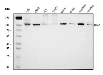 AP2A2 Rabbit Polyclonal Antibody