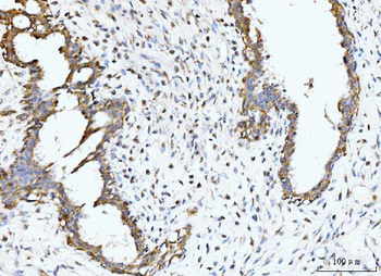 BCKDK Rabbit Polyclonal Antibody
