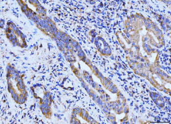 BCKDK Rabbit Polyclonal Antibody