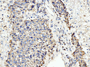 BCKDK Rabbit Polyclonal Antibody