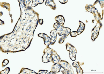 BCKDK Rabbit Polyclonal Antibody