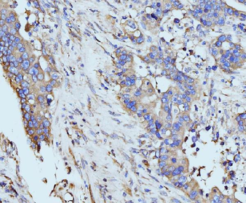 BZW2 Rabbit Polyclonal Antibody
